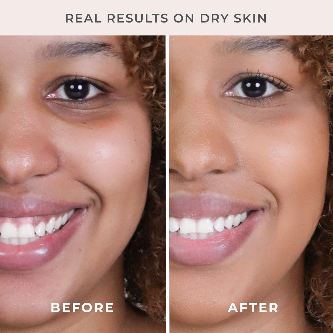 5-Piece Start Now Set Darker Shade Before and After model