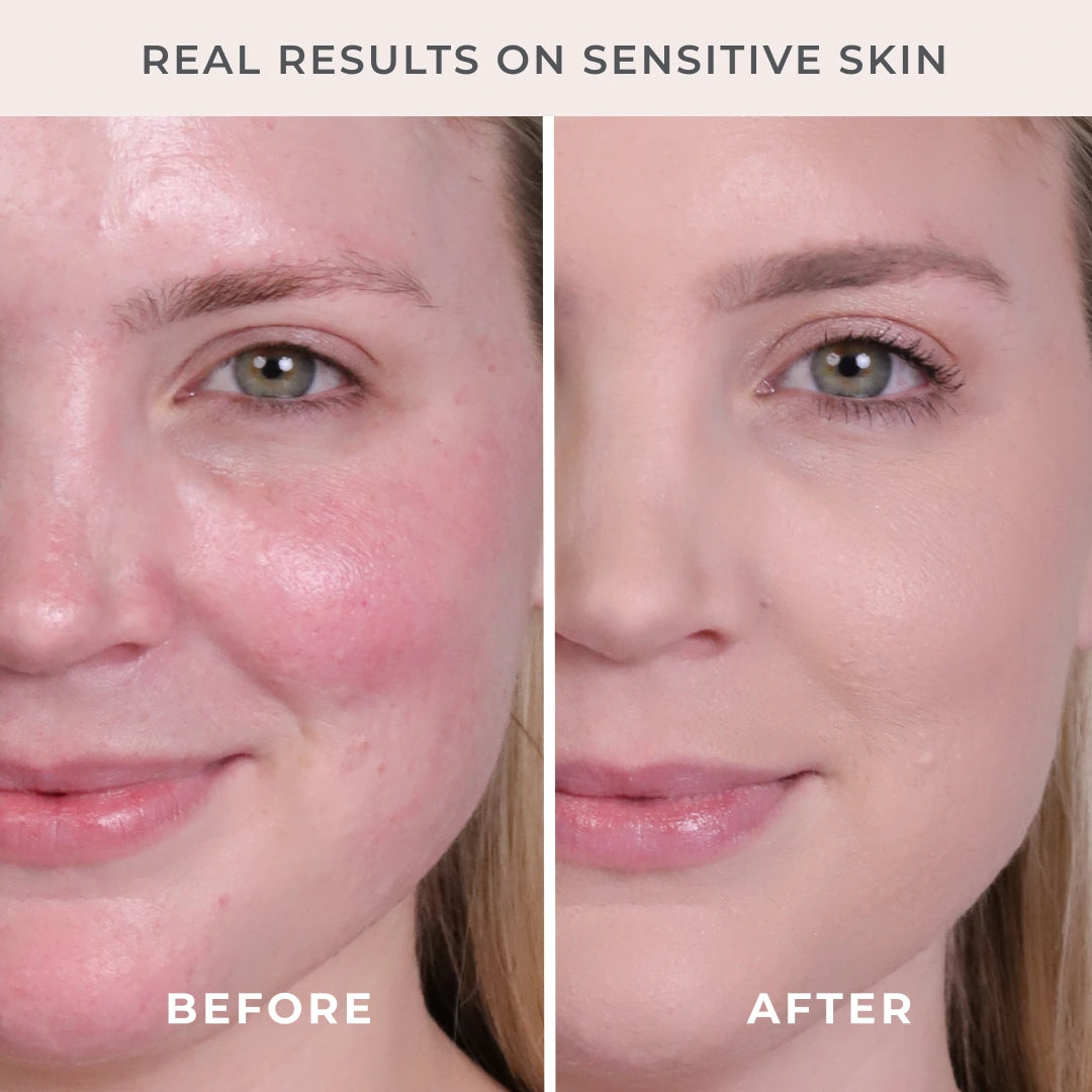 5-Piece Start Now Set Lighter Shade Before and After model