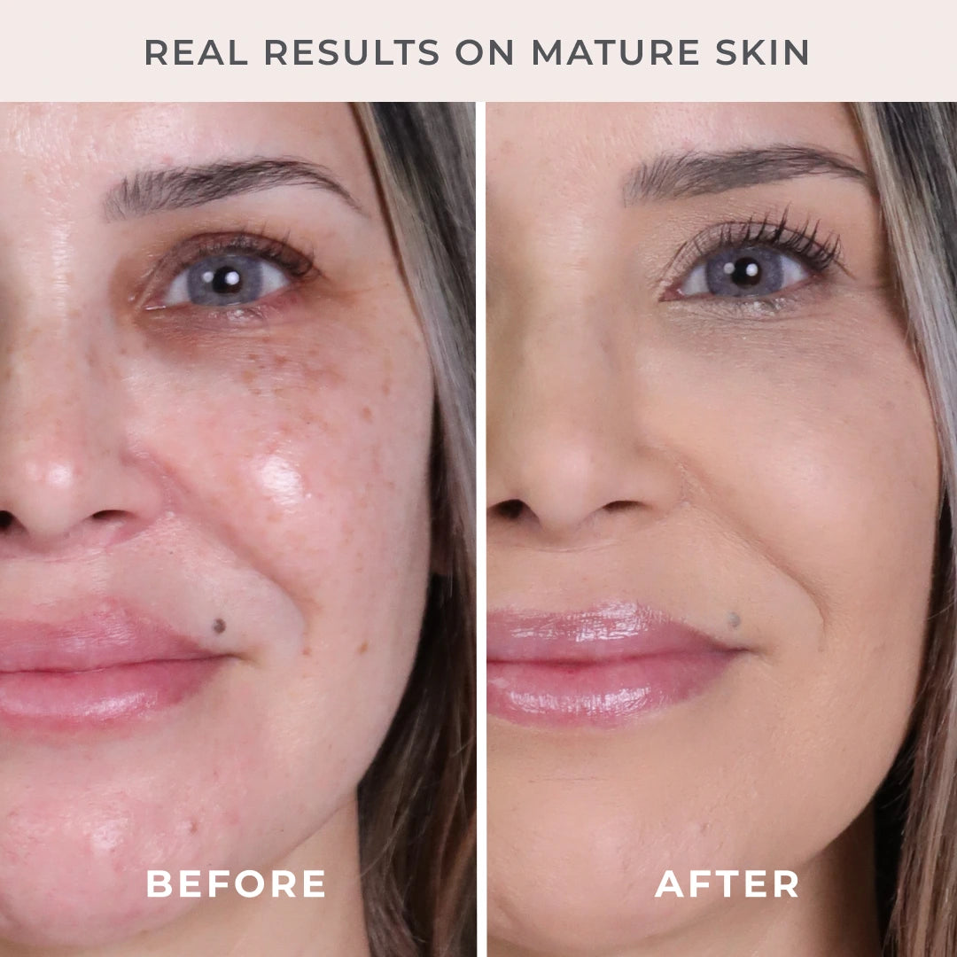 5-Piece Start Now Set Medium Shade Before and After model